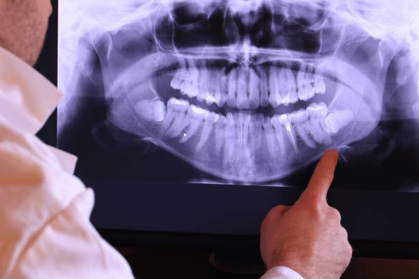 Best Emergency Treatment for Oral Infections in Pooler, GA