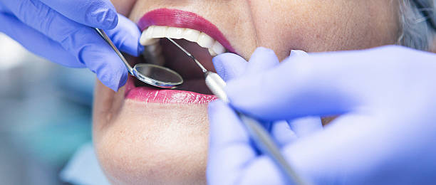 Best Dental Abscess Treatment in Pooler, GA